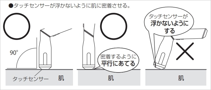 ホームストラッシュ照射の注意点