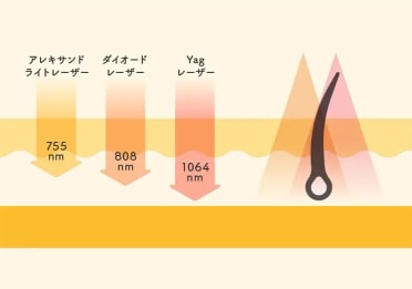 じぶんクリニック ラシャトリニティプロの波長の長さ