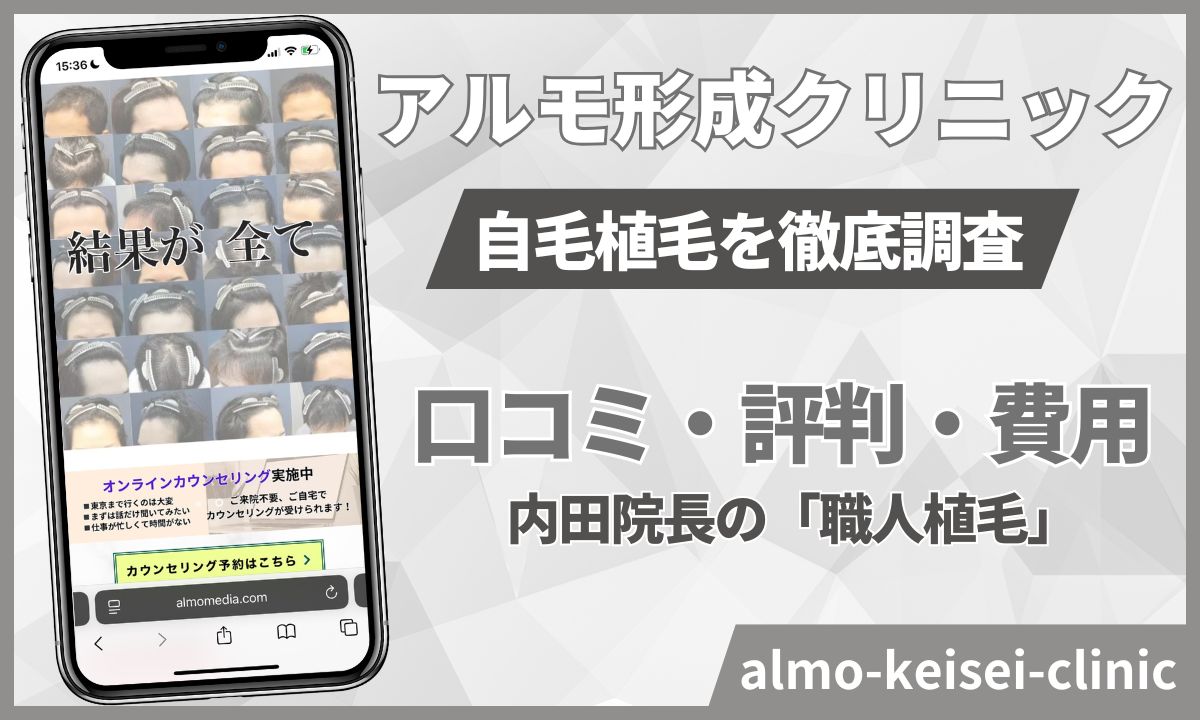 アルモ形成クリニックの自毛植毛レビュー！内田院長の口コミ・料金・支払い方法【2026年版】
