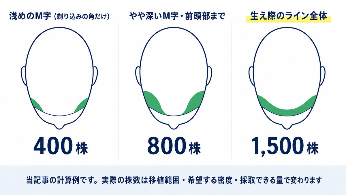 M字の移植範囲が広がるほど必要な株数が増えることを示す図