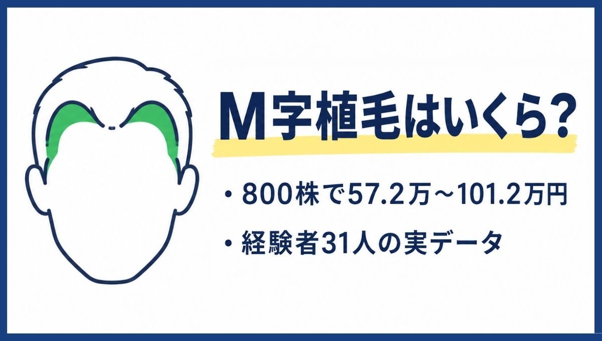 M字だけの植毛に必要な株数と費用を解説するアイキャッチ画像