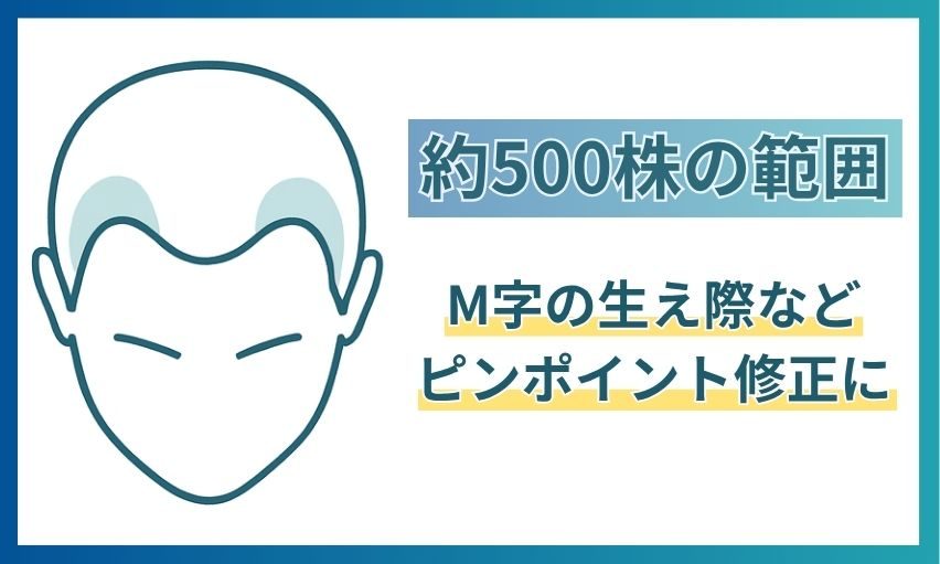 約500株でカバーできる範囲。浅いM字や生え際のピンポイント修正にあたることを示した図