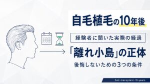 自毛植毛の10年後。経験者に聞いた実際の経過と離れ小島の正体